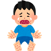 子どもの発疹が出る主な病気