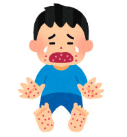 子どもの発疹が出る主な病気